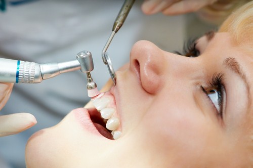 Cách điều trị bệnh viêm nướu răng 1