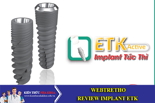 Webtretho review Implant ETK Active của Nha Khoa Đông Nam -1