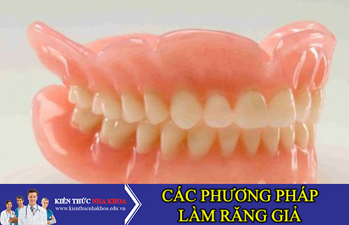 các phương pháp làm răng giả