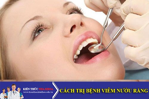 cách trị bệnh viêm nướu răng