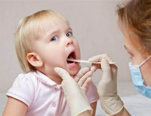nguyên nhân và cách chữa bệnh hôi miệng ở trẻ nhỏ