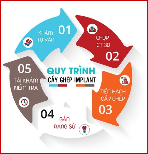 Quy trình cấy ghép đúng tiêu chuẩn