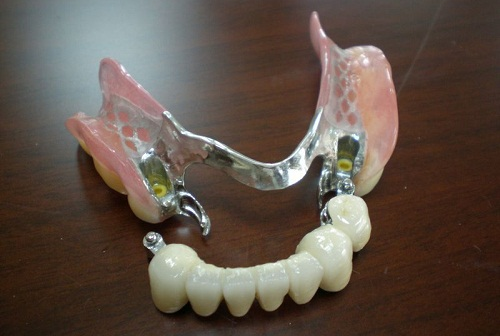 hàm khung liên kết