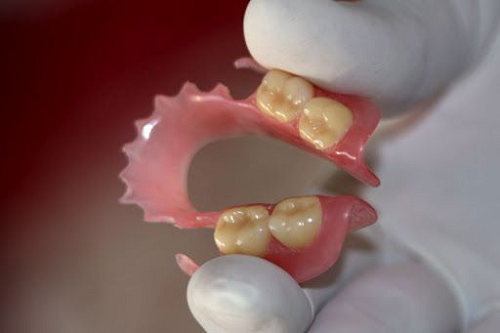 hàm tháo lắp bằng nhựa dẻo