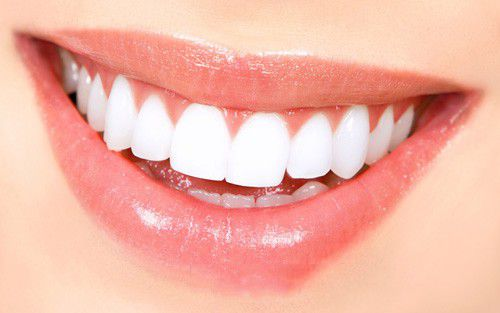 loi ich cua viec cay ghep implant