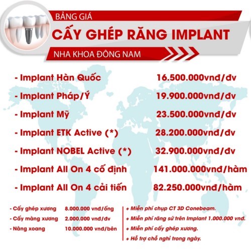 Bảng chi phí các loại răng Implant tại Nha Khoa Đông Nam