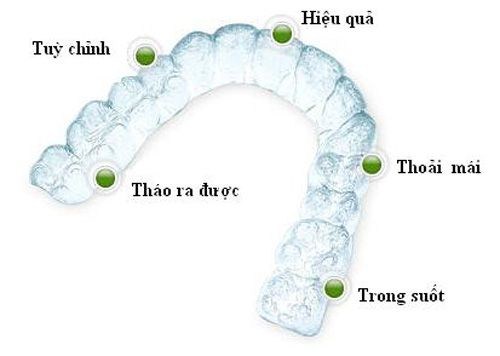 niềng răng tháo lắp có hiệu quả không 3