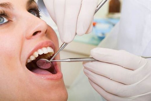 tại sao bị khuyết cổ răng? cách phòng ngừa bệnh như thế nào 7