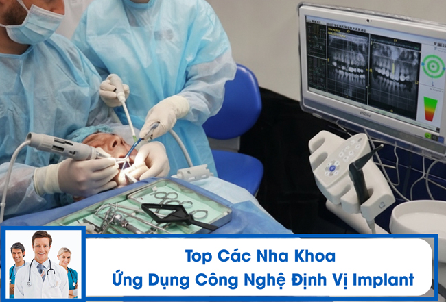 Top Các Nha Khoa Ứng Dụng Công Nghệ Định Vị Implant